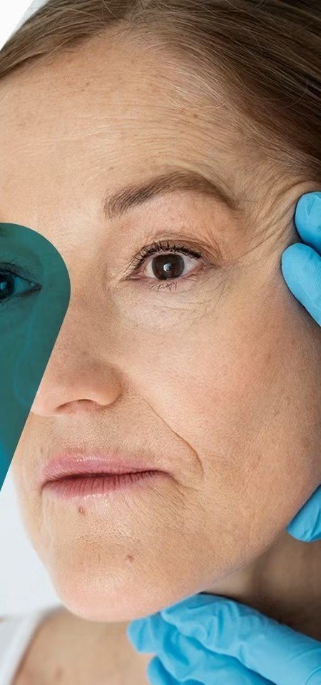 Rehabilitación de parálisis facial